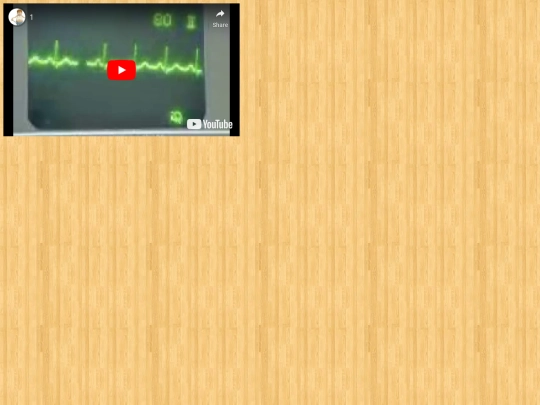EKG/1 screenshot