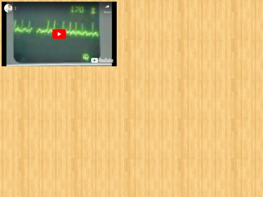 EKG/2 screenshot