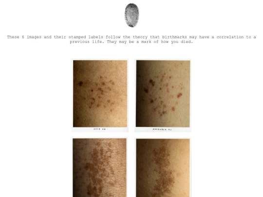 birthmarks screenshot