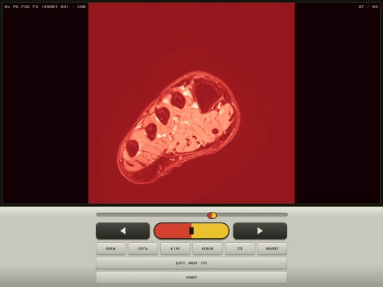MRi screenshot
