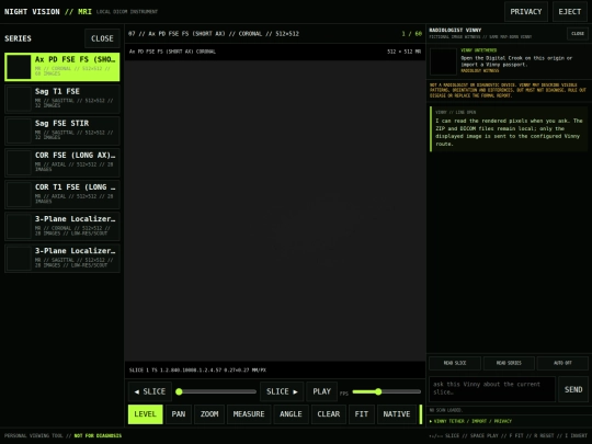 Mri4 screenshot