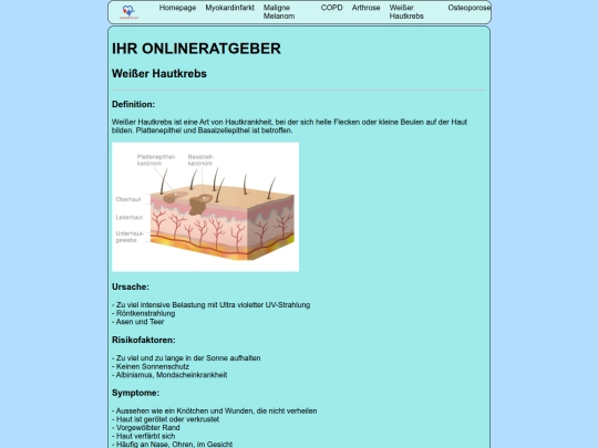 Weißer Hautkrebs screenshot
