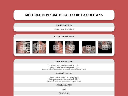 locomotor/musculos/espinosoerectordelacolumna screenshot