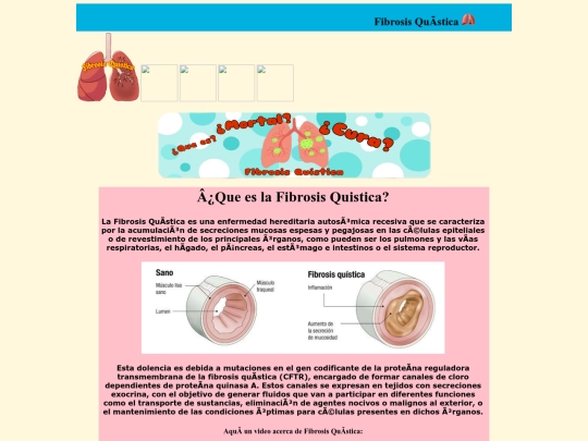 Fibrosis screenshot