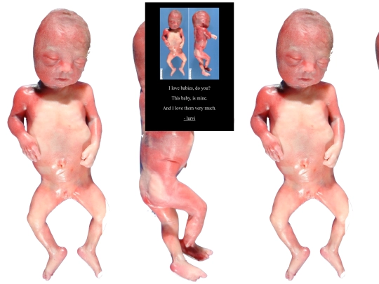 fetusyetus screenshot