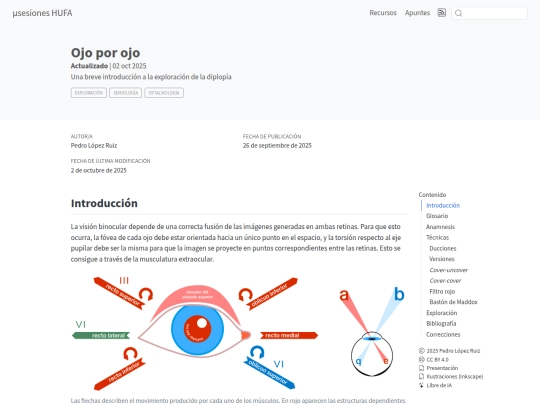 posts/202509_pedro_diplopia screenshot