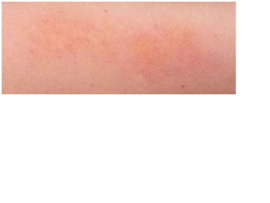 info/makeup-long-bruise screenshot
