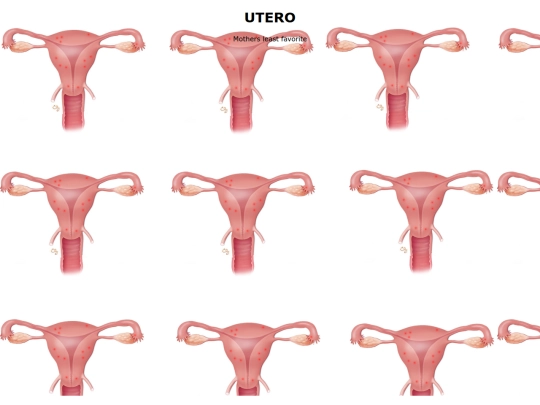 UTERO screenshot