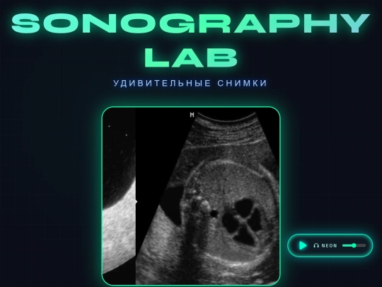 ussssssss.html/sonography screenshot