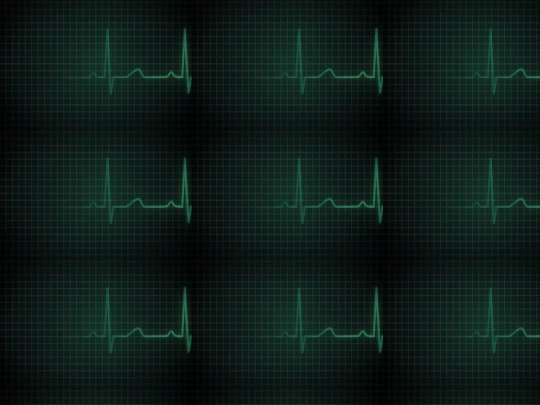 bouncingekg screenshot