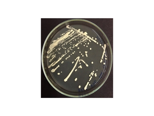 yeast screenshot