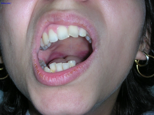 pagina2denti screenshot