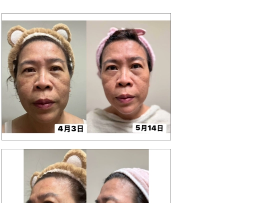 HO/對比照250608 screenshot