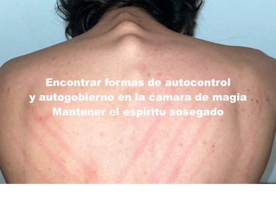 espalda1 screenshot