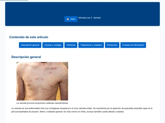 articulos/varicela screenshot