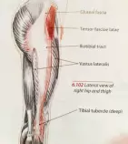 Project/images/tensor_fascia_lata.jpg