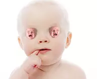 cryeye.png