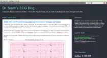 sites pics/ECG/Dr._Smith_s_ECG_Blog_-_2016-04-09_15.42.50.png