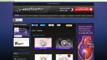sites pics/ECG1/ECG_Tutorial_-_2016-04-11_06.53.09.png