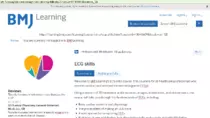sites pics/ECG1/ECG_skills_-_2016-04-11_06.58.55.png