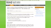 sites pics/ECG1/How_to_read_an_Electrocardiogram_(ECG)._Part_One_Basic_principles_of_the_ECG._The_normal_ECG_-_2016-04-11_07.35.46.png