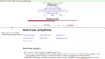 sites pics/ECG1/Ventricular_arrhythmias_-_2016-04-13_11.33.17.png