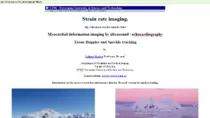 sites pics/Echo/Strain_Rate_Imaging.png