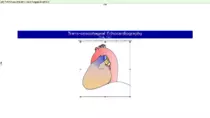 sites pics/Echo/Transoesophageal_Echocardiography.png