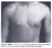 img/fig120-2.png