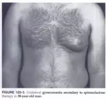 img/fig120-3.png