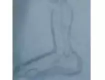 page1_pictures/foot_line_contour_thumb.jpg