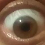img/eye.jpg
