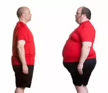 Obesity.jpg