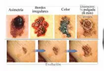 imagenes/im3.jpg